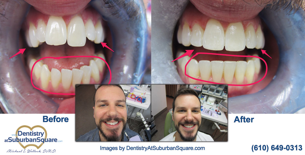 David before and after teeth
