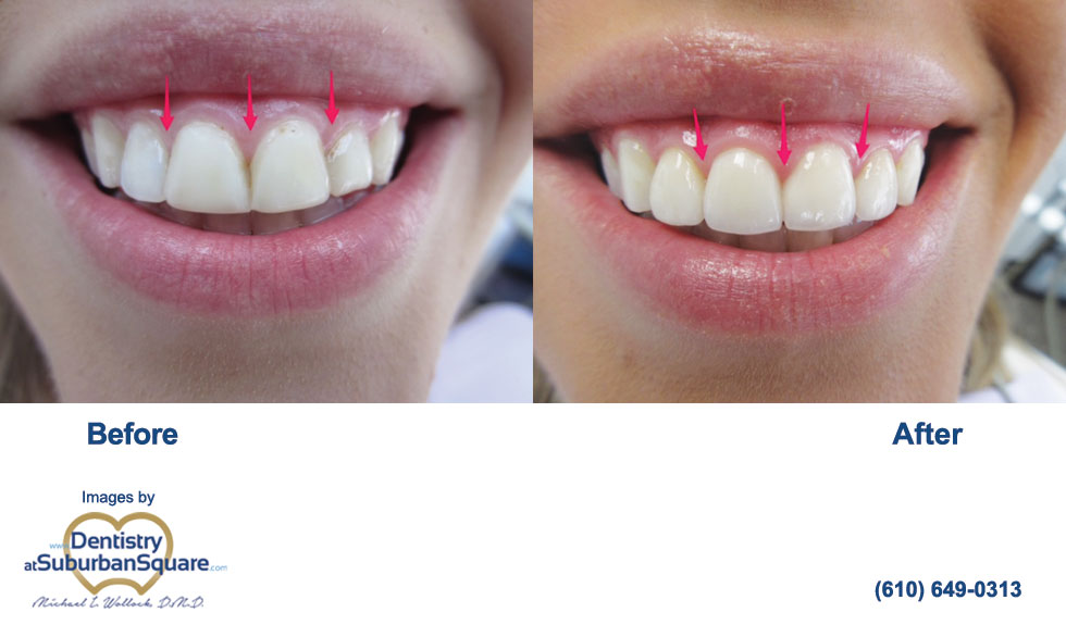 Taylor's Cosmetic Dentistry Before and After