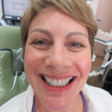 Anabela after Invisalign